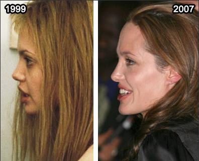 Анджелина Джоли заявила, что не делала пластические