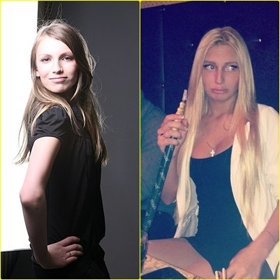 Участница "Дома 2", Анна Кудимова, до и после операции